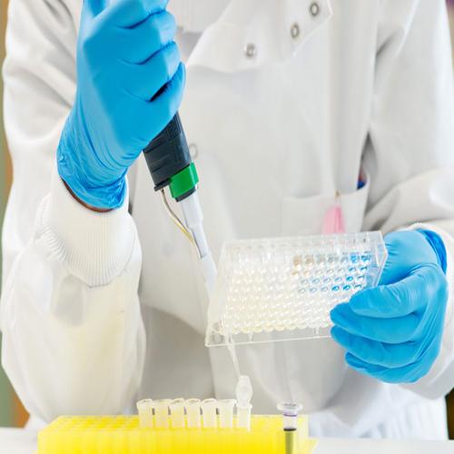 Discover the new way to improve the assessment of prostate cancer aggressiveness