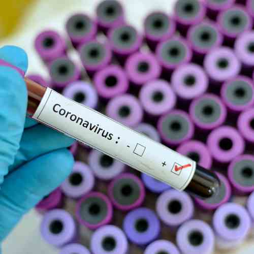 The coronavirus could be dangerous for more for mature economies too