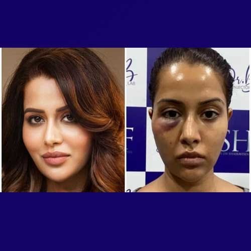 Actress Raiza Welson seeks â‚¹1cr from dermatologist